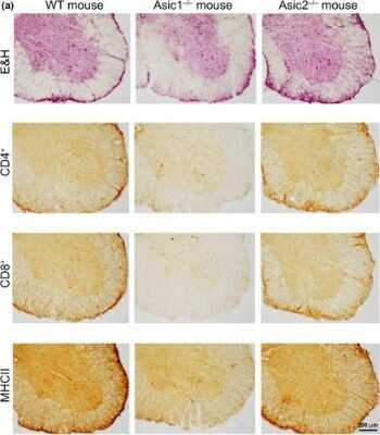 Immunohistochemistry: CD8 Antibody (53-6.7) - BSA Free [NBP1-49045]
