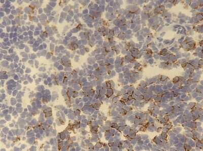 Immunohistochemistry-Paraffin: CD8 Antibody (53-6.7) - BSA Free [NBP1-49045]