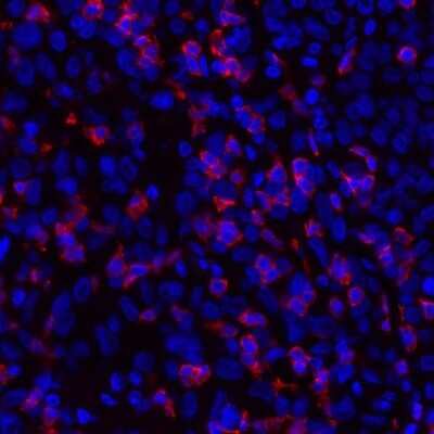 Immunocytochemistry/ Immunofluorescence: CD8 Antibody (BLR044F) [NBP2-76422]