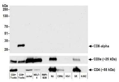 Western Blot: CD8 Antibody (BLR044F) [NBP2-76422]