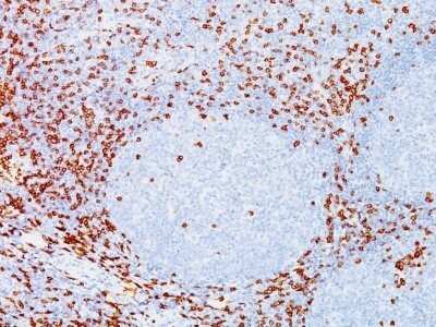 Immunohistochemistry-Paraffin: CD8 Antibody (C8/144B) - Azide and BSA Free [NBP2-34588]