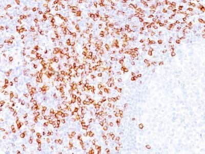 Immunohistochemistry-Paraffin: CD8 Antibody (C8/144B) - Azide and BSA Free [NBP2-34588]