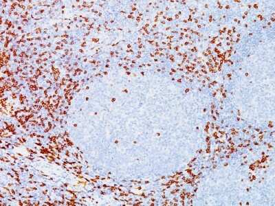 Immunohistochemistry-Paraffin: CD8 Antibody (C8/144B) [NBP2-32836]