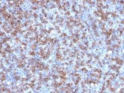 Immunohistochemistry-Paraffin: CD8 Antibody (C8/1779R) [NBP2-53189]