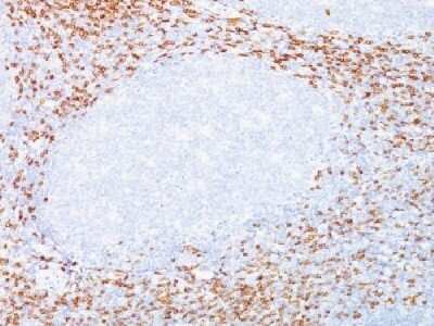 Immunohistochemistry-Paraffin: CD8 Antibody (C8/468 + C8/144B) - Azide and BSA Free [NBP2-34590]