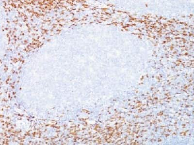 Immunohistochemistry-Paraffin: CD8 Antibody (C8/468 + C8/144B) [NBP2-34318]