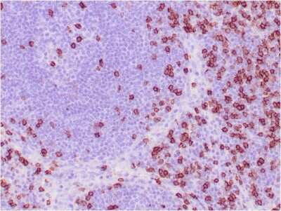 Immunohistochemistry-Paraffin: CD8 Antibody (C8/468) - Azide and BSA Free [NBP2-34589]