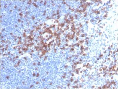 Immunohistochemistry-Paraffin: CD8 Antibody (C8/468) - Azide and BSA Free [NBP2-34589]