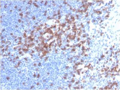 Immunohistochemistry-Paraffin: CD8 Antibody (C8/468) [NBP2-32952]