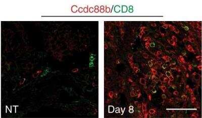 Immunohistochemistry-Frozen: CD8 Antibody [NBP2-29475]