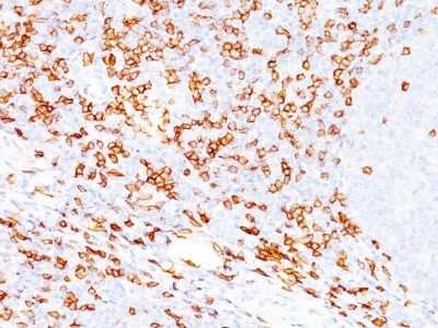 Immunohistochemistry-Paraffin: CD8 Antibody (SPM548) - Azide and BSA Free [NBP2-34790]