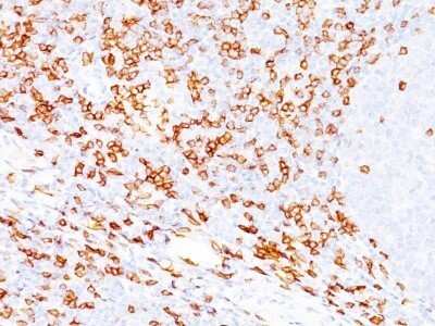 Immunohistochemistry-Paraffin: CD8 Antibody (SPM548) - IHC-Prediluted [NBP2-45324]