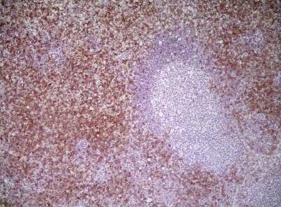 Immunohistochemistry-Frozen: CD8 Antibody (YTS105.18) - BSA Free [NB200-578]