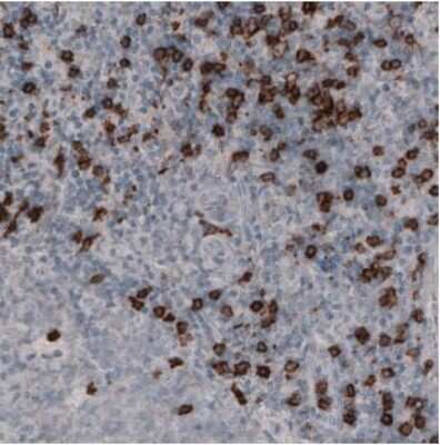 Immunohistochemistry-Paraffin: CD8 Antibody (CL1529) [NBP2-36743]