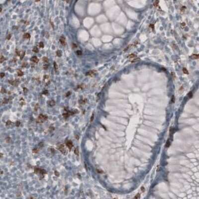 Immunohistochemistry-Paraffin: CD8 Antibody (CL1529) [NBP2-36743]