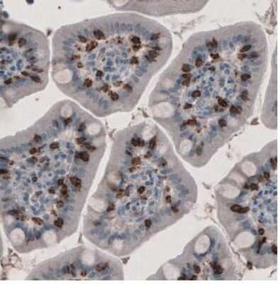 Immunohistochemistry-Paraffin: CD8 Antibody (CL1529) [NBP2-36743]
