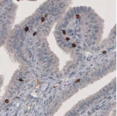 Immunohistochemistry-Paraffin: CD8 Antibody (CL1529) [NBP2-36743]