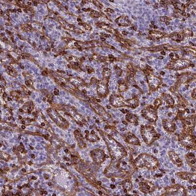 Immunohistochemistry-Paraffin: CD8 Antibody [NBP2-34039]