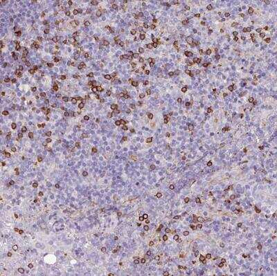Immunohistochemistry-Paraffin: CD8 Antibody [NBP2-34039]