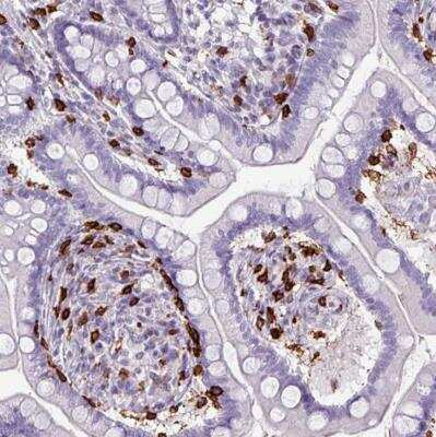 Immunohistochemistry-Paraffin: CD8 Antibody [NBP2-34039]