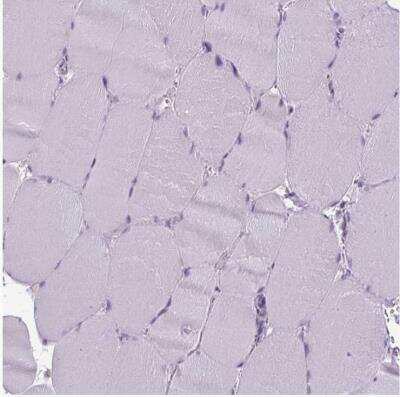 Immunohistochemistry-Paraffin: CD8 Antibody [NBP2-34039]