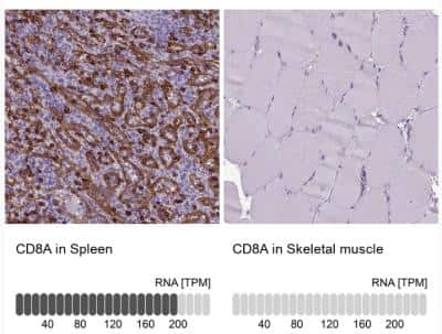 Immunohistochemistry-Paraffin: CD8 Antibody [NBP2-34039]