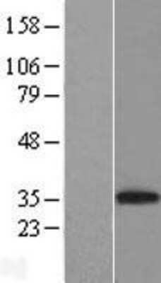 Western Blot: CD8 Overexpression Lysate [NBP2-10773]