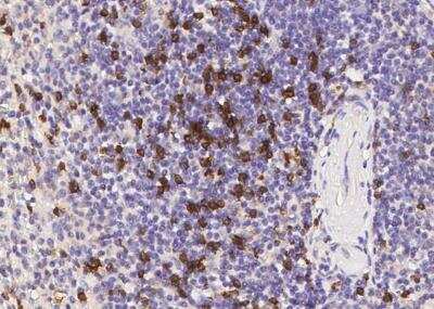 Immunohistochemistry-Paraffin: CD8 beta Antibody (039) [NBP2-89751]
