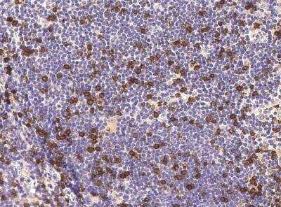 Immunohistochemistry-Paraffin: CD8 beta Antibody (039) [NBP2-89751]