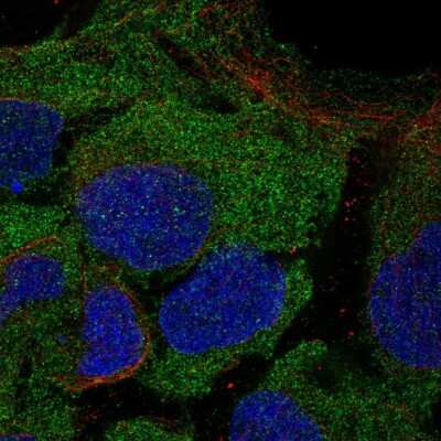 Immunocytochemistry/ Immunofluorescence: CD8 beta Antibody [NBP2-58425]