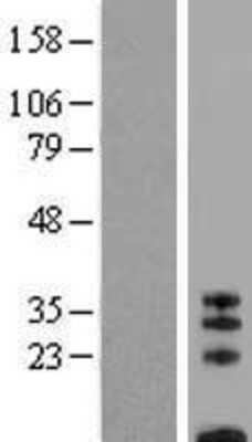 Western Blot: CD8 beta Overexpression Lysate [NBP2-05170]