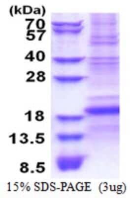 SDS-PAGE: Recombinant Human CD8 beta His Protein [NBP2-51536]