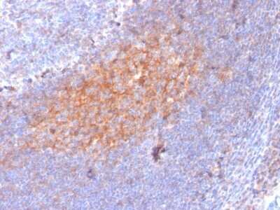 Immunohistochemistry-Paraffin: CD81 Antibody (1.3.3.22) - Azide and BSA Free [NBP2-54548]