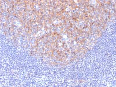 Immunohistochemistry-Paraffin: CD81 Antibody (1.3.3.22) - Azide and BSA Free [NBP2-54548]