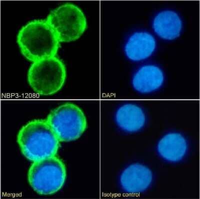 Immunocytochemistry/ Immunofluorescence: CD81 Antibody (1.3.3.22) - Chimeric - Azide and BSA Free [NBP3-12080]