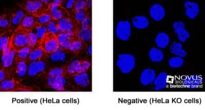 Knockout Validated: CD81 Antibody (1.3.3.22) [NBP2-53318]