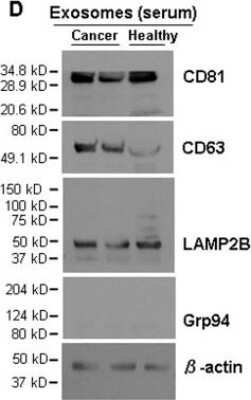 Western Blot: CD81 Antibody (1D6)Azide and BSA Free [NBP2-80660]