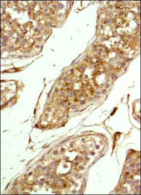 Immunohistochemistry-Paraffin: CD81 Antibody (1D6) - BSA Free [NB100-65805]
