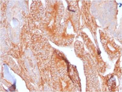 Immunohistochemistry-Paraffin: CD81 Antibody (C81/2885R) - Azide and BSA Free [NBP3-08796]