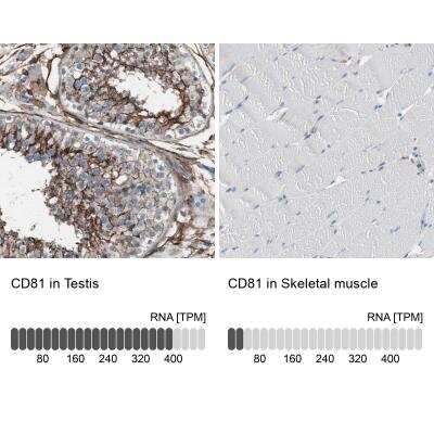 Immunohistochemistry-Paraffin: CD81 Antibody [NBP1-80701]