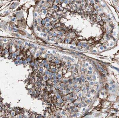 Immunohistochemistry-Paraffin: CD81 Antibody [NBP1-80701]
