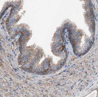 Immunohistochemistry-Paraffin: CD81 Antibody [NBP1-80701]