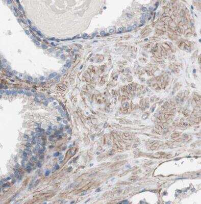 Immunohistochemistry-Paraffin: CD81 Antibody [NBP1-80701]