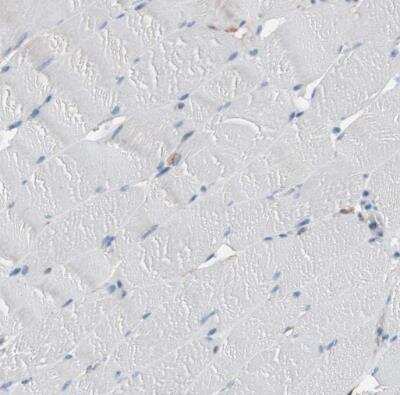 Immunohistochemistry-Paraffin: CD81 Antibody [NBP1-80701]