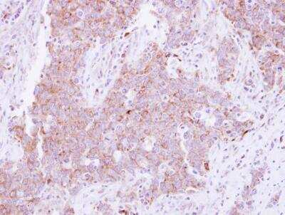 Immunohistochemistry-Paraffin: CD81 Antibody [NBP2-20564]