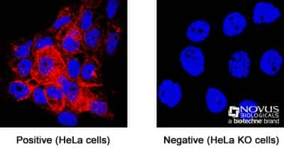 Knockout Validated: CD81 Antibody (M38) - BSA Free [NBP1-44861]