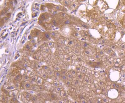 Immunohistochemistry-Paraffin: CD81 Antibody (SN206-01) [NBP2-67722]