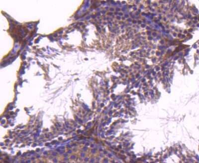 Immunohistochemistry-Paraffin: CD81 Antibody (SN206-01) [NBP2-67722]