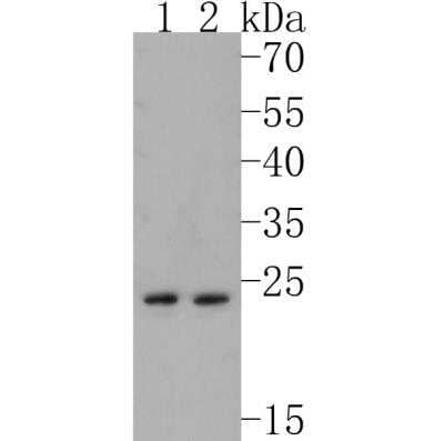 Western Blot: CD81 Antibody (SN206-01) [NBP2-67722]