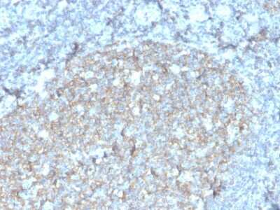 Immunohistochemistry-Paraffin: CD81 Antibody (rC81/3442) - Azide and BSA Free [NBP3-08795]